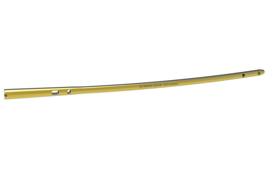 Interlocking Femoral Nail (Reamed)